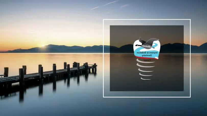 Goose Creek Charleston Implant and Sedation Dentistry