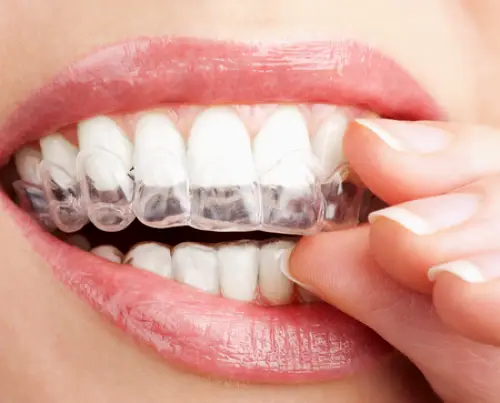  Humble Houston Dental Implants Family Dentistry Oral Surgery And Periodontics