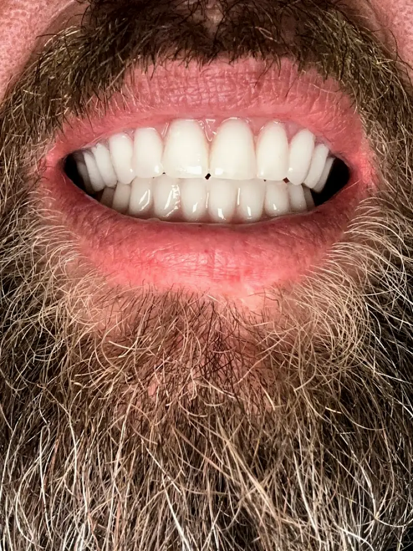 Lake Whitney Dental