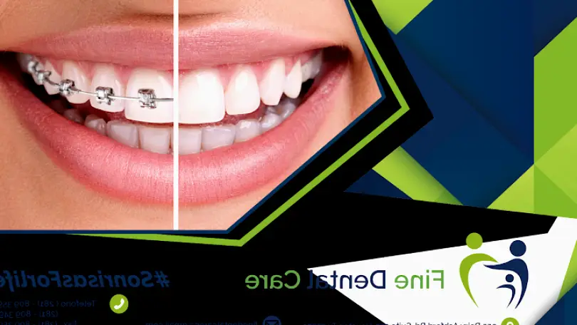  Memorial Fine Dental Houston