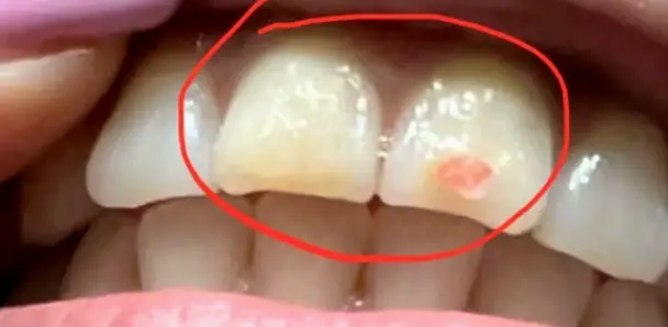 Villa Park Bright Dental Smiles: Jaspreet Dhingra Bajaj DDS