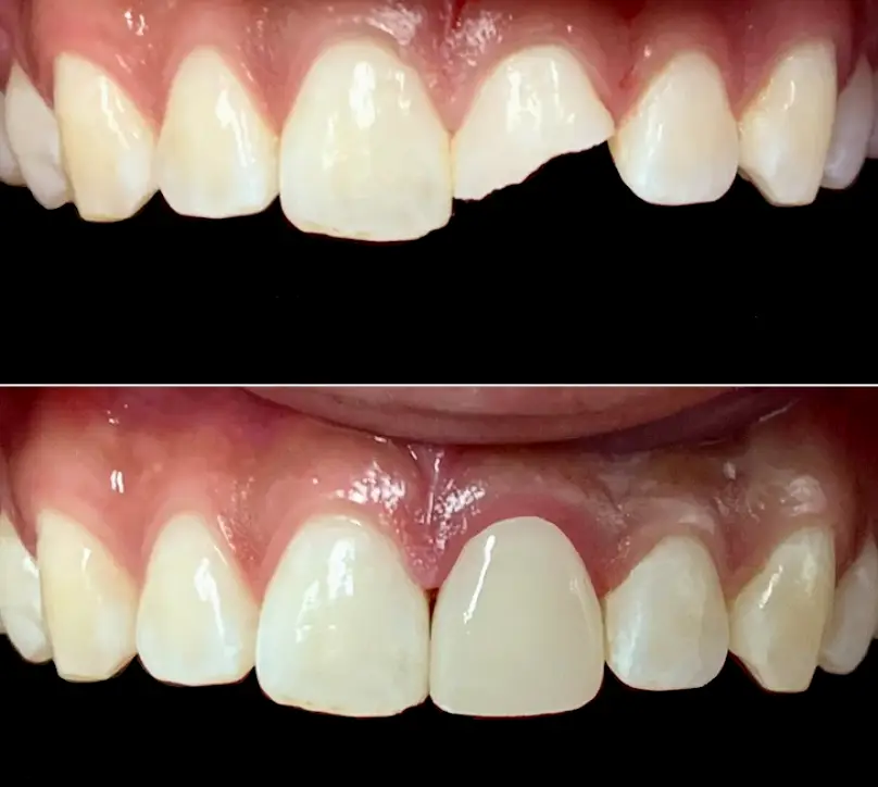 El Cajon Professional Family Dental