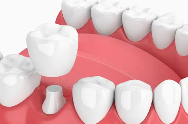 Desert Valley Dental | Sparks