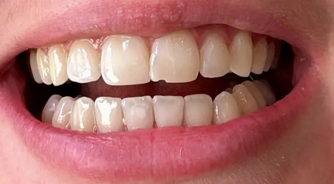Mililani Mauka Family Dental