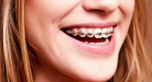 Vestavia Hills Abenoja Orthodontics at Liberty Park