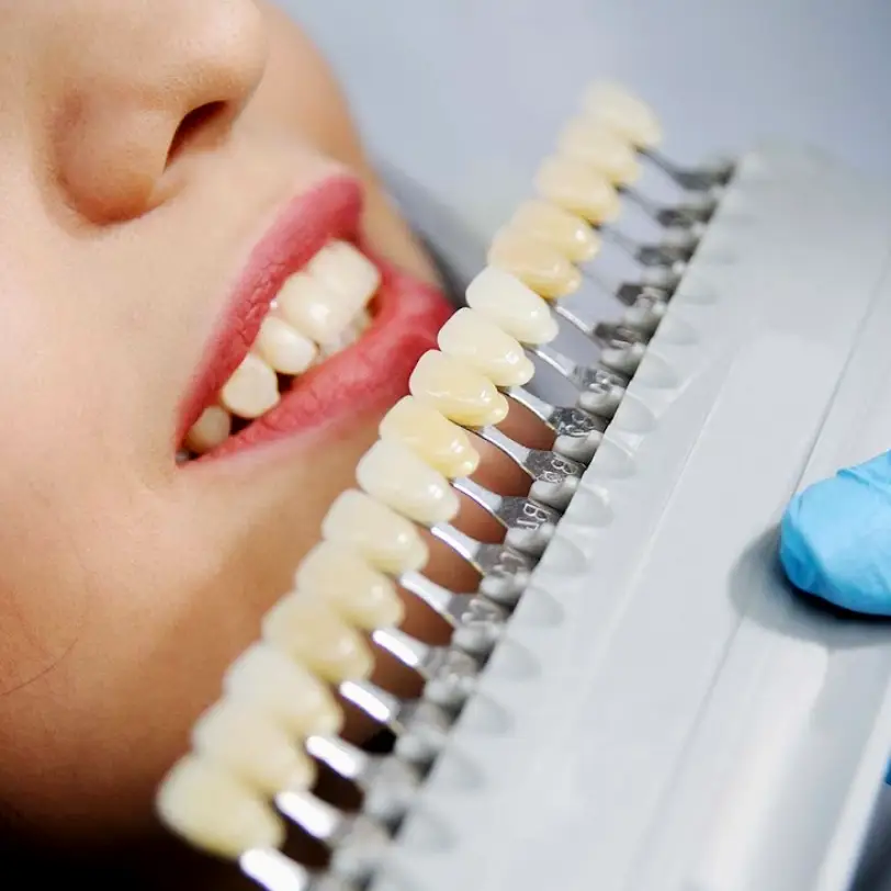 Cornelius Natural White In-Office Teeth Whitening