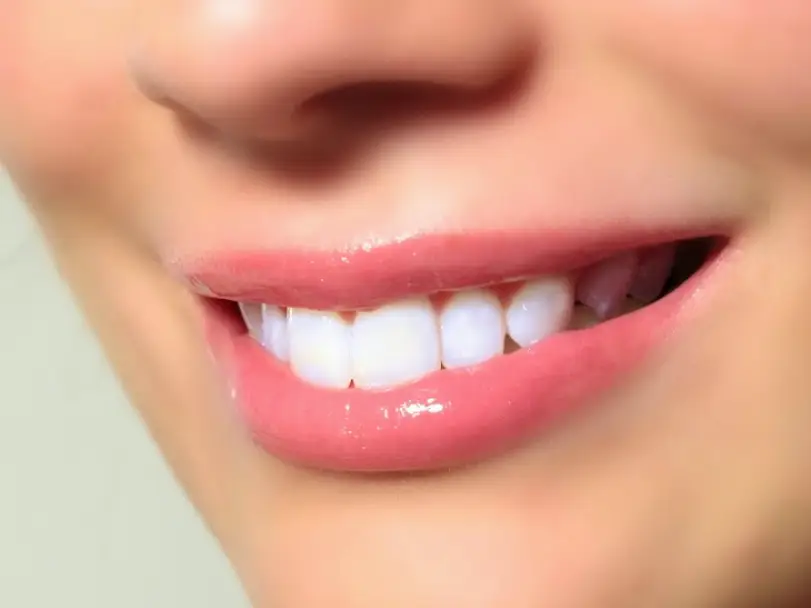 Edmonds Roy Carlson DDS MAGD