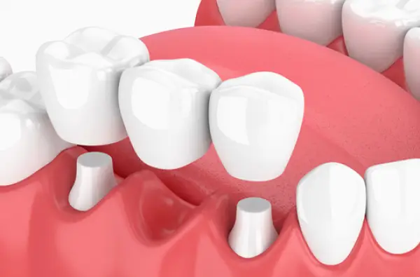 Mt Clemens Enhance Family Dental
