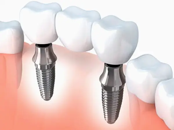 Laguna Hills Elite Dental Group
