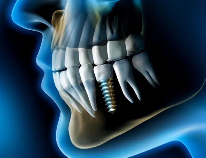 Yonkers James C. Melillo, DDS