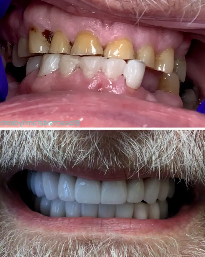 Dentist Indialantic - Beachside Family Dentistry - Jessica L. Mansfield DDS