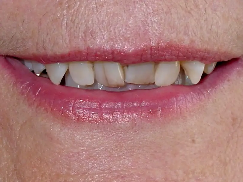 Lakewood Curtis D Johnsen, DDS, FAGD