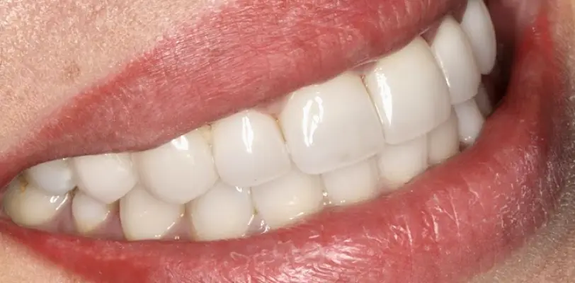 Yorba Linda Imperial Smile Dentistry
