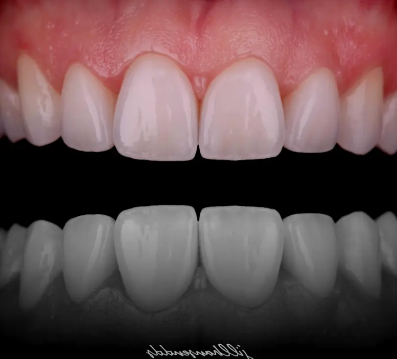  Gig Harbor Spaulding Dental Co.