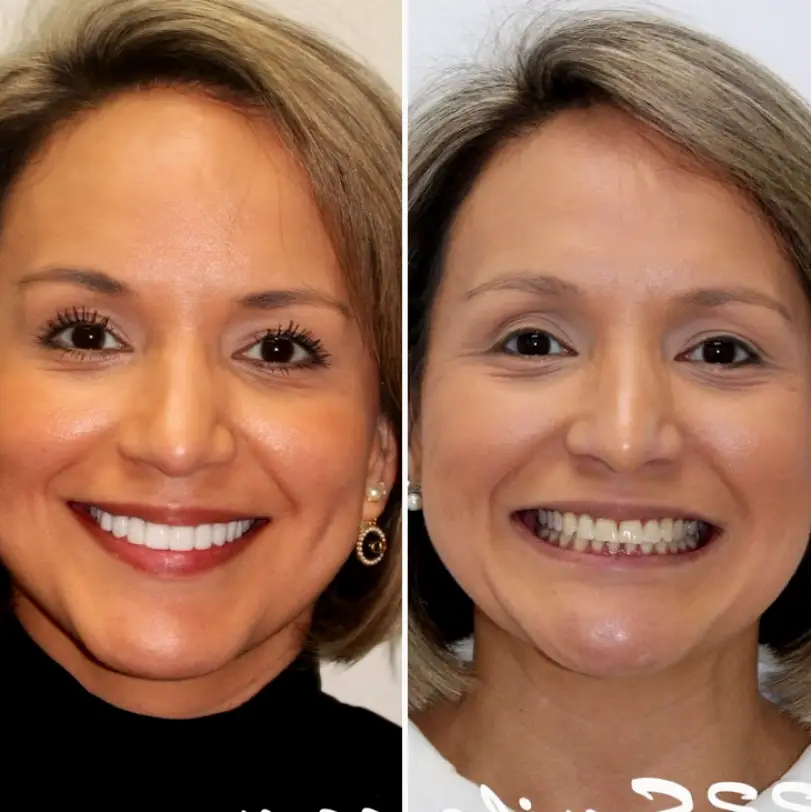  San Antonio Cosmetic Dental Associates - Alamo Ranch