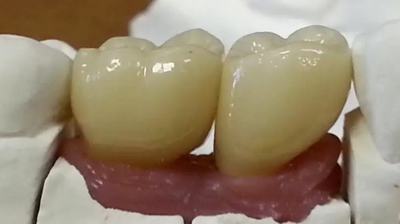 Thomasville High Tech Dental Laboratory INC.