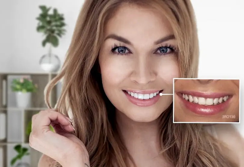 La Puente Hacienda Family Dental