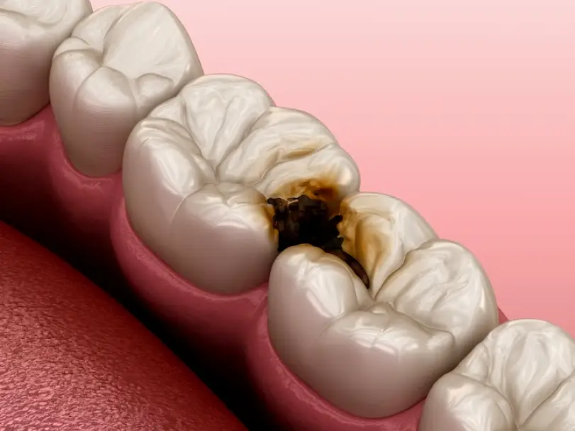 Mt Horeb Village Smile Care