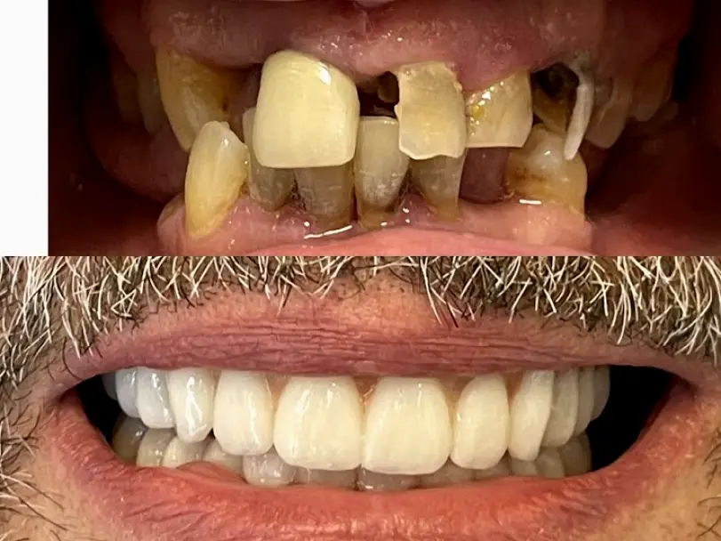 Ballston Spa Salvatore Dental