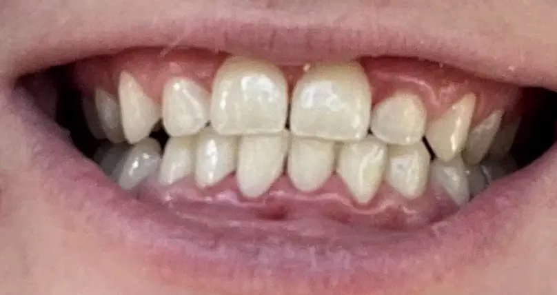  Omaha Millard Hills Dental Health Center