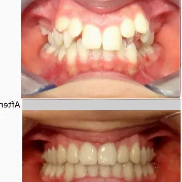 Abington emergency and Implant dentist