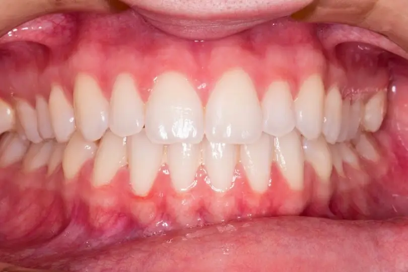 Brooksville The Dental & Denture Care Center