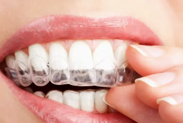 El Cajon Dr. Alena Nawrocki, DDS