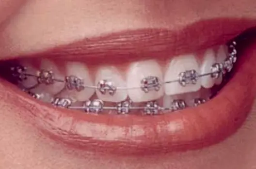 Laplace Dr. Guy W. Favalaoro, DDS