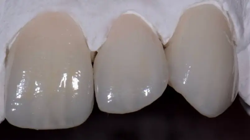 Missoula JTL Dental Lab, Inc.