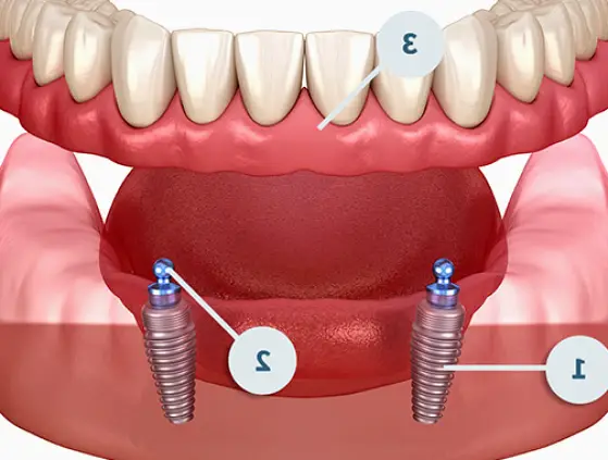 Pompano Beach Emergency Dentist & Dentures 24-7