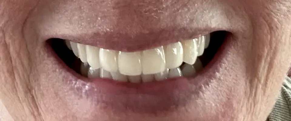 Sun City Center Dental Associates of Florida Cosmetic & Implant Dentistry
