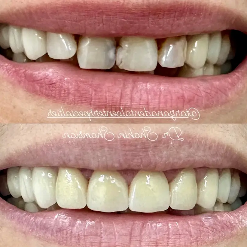 Tarzana Shahin Shamsian DDS