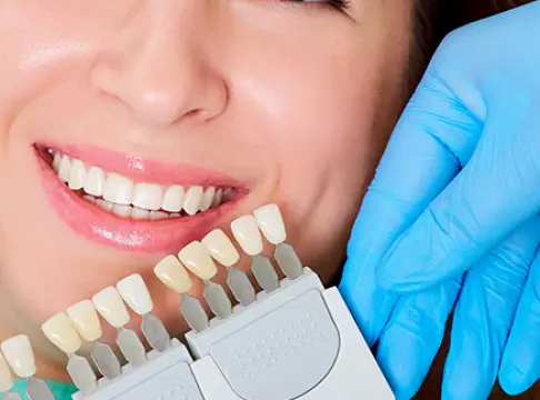  Schenectady Glenville Smiles
