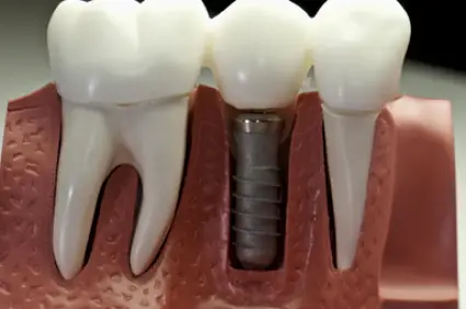 Ann Arbor A2 Dental Care