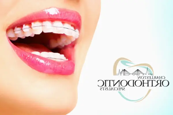 North Charleston Charleston Orthodontics
