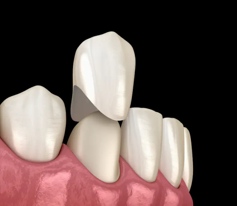 Flemington Trecartin Family Dentistry