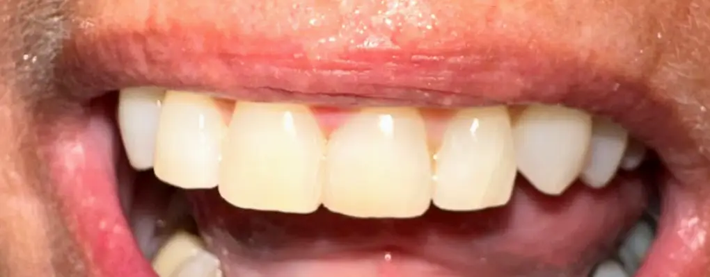 Morrison Cornerstone Family Dentistry