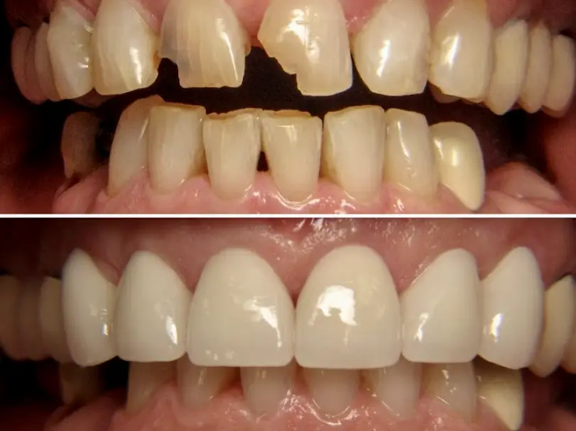 Coeur d'Alene Orban Family Dental