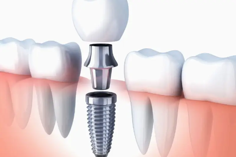 Corona Abbey Dental, Inc.