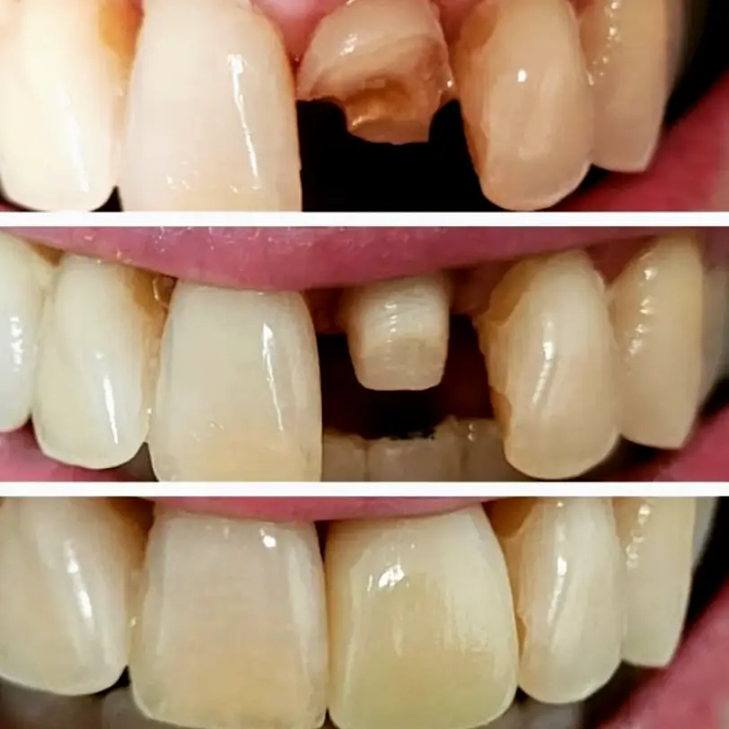  Delray Beach NICOLAS FAKHOURY D.M.D. AT FAMILY DENTAL CARE