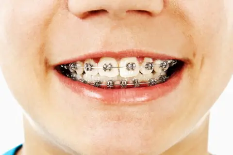 Element Dental & Orthodontics Tomball