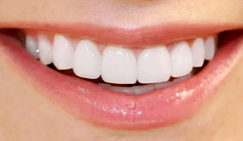 Irving My DFW Dentist