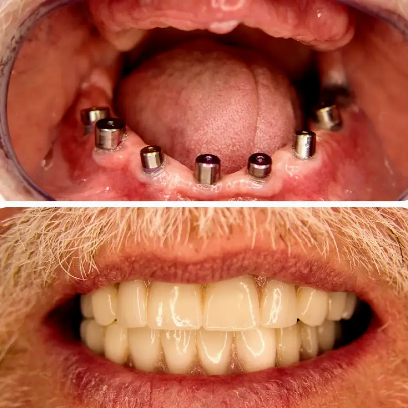 Woodland SpringLake Dental