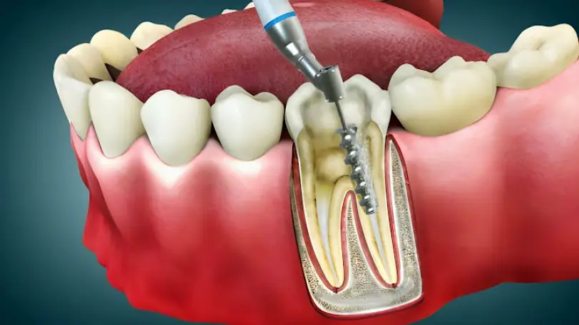 Lynn Haven Dental Specialists