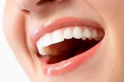 Sedation Dentistry of San Jose