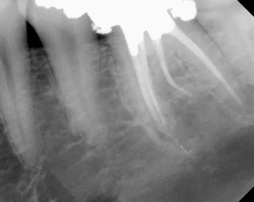 Carson City Endodontics