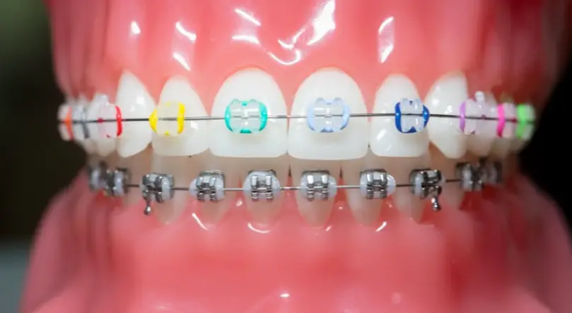 Cuyahoga Falls Casellas Orthodontics