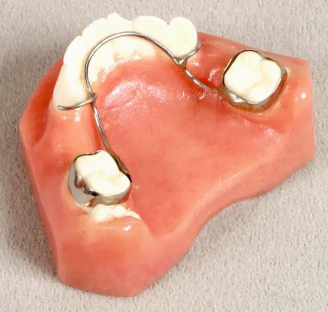 Fenton Ordont Orthodontic Appliance Laboratories