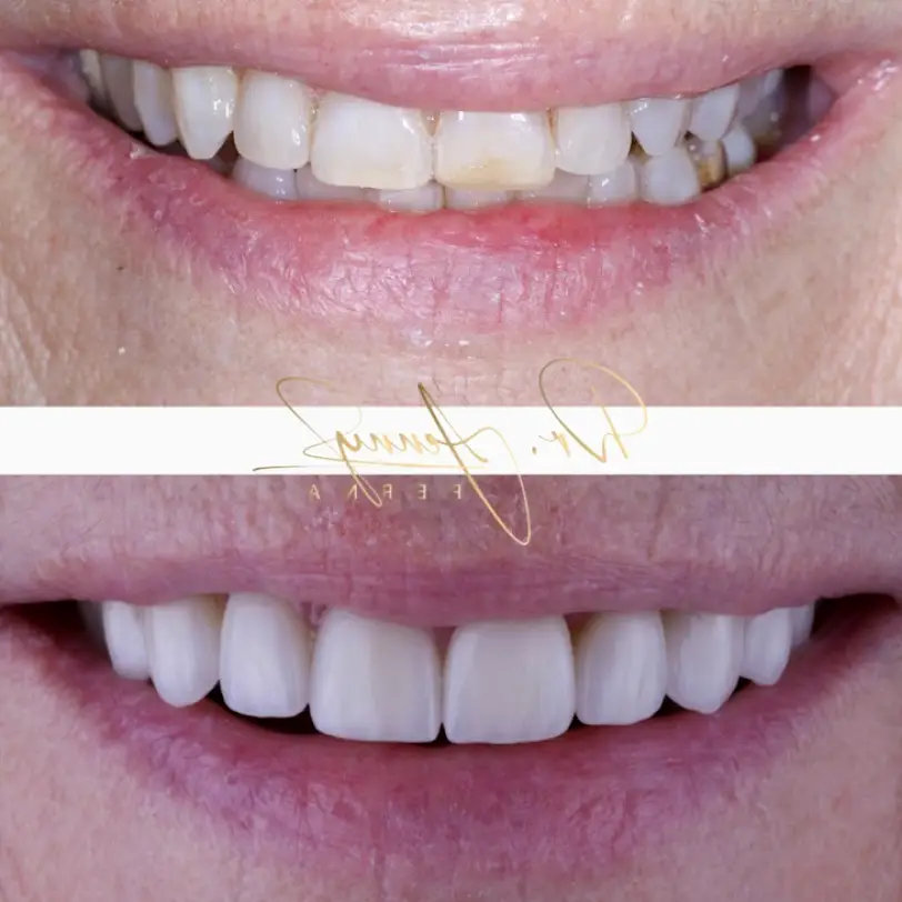  Flosswell Dental Jupiter