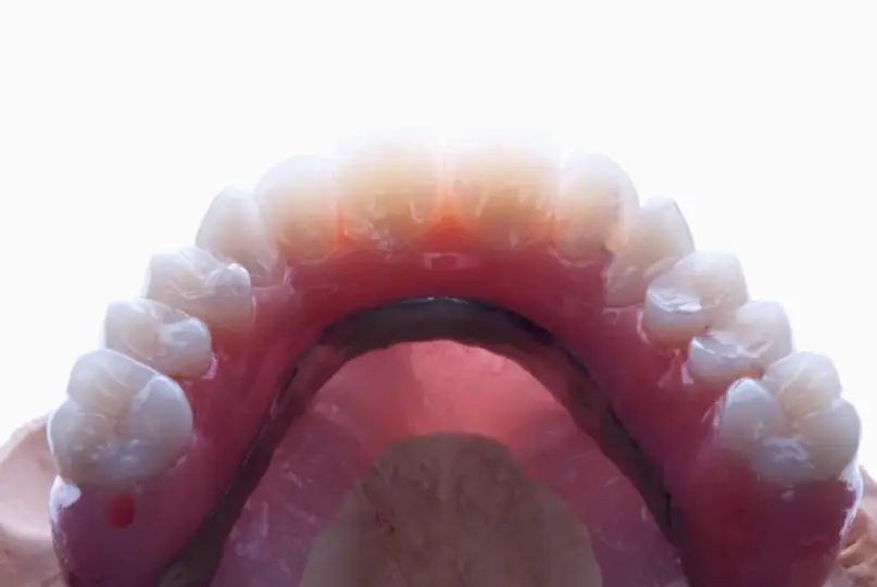 Bellevue Pacific Northwest Prosthodontic Laboratory